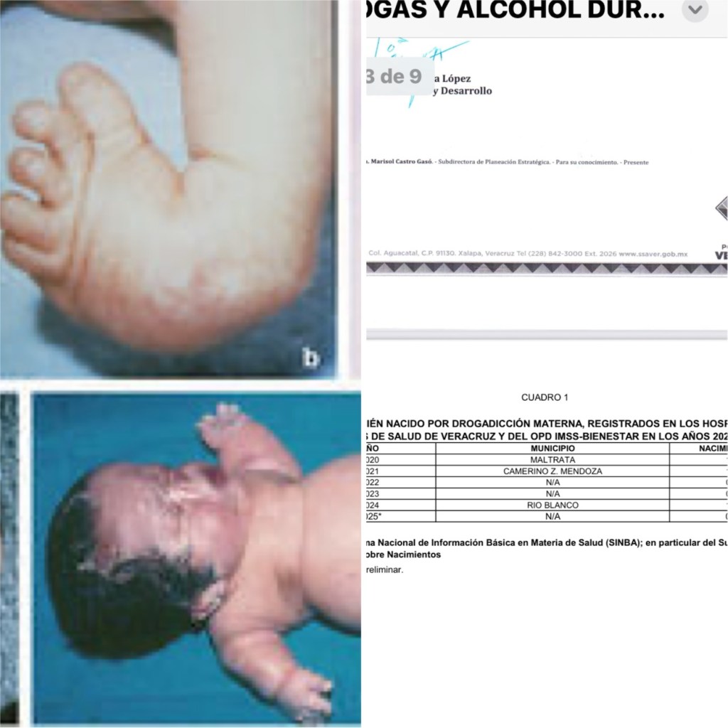 Crecen casos de bebés en Veracruz que tienen problemas fetales porque sus madres jóvenes consumen drogas y alcohol en el&nbsp;embarazo